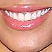 Pop Quiz: Guess That Smile!