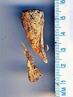 Bone Fragments May Belong to Amelia Earhart| Amelia Earhart