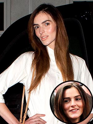 Ali Lohan's New Face Explained | Ali Lohan