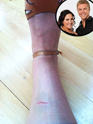 Dancing with the Stars - Ricki Lake Injured