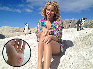Shakira Injured After Brush with Aggressive Sea Lion | Shakira