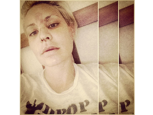 Lisa D'Amato of America's Next Top Model Seriously Injures Face in Freak Accident| Health, America's Next Top Model, Real People Stories