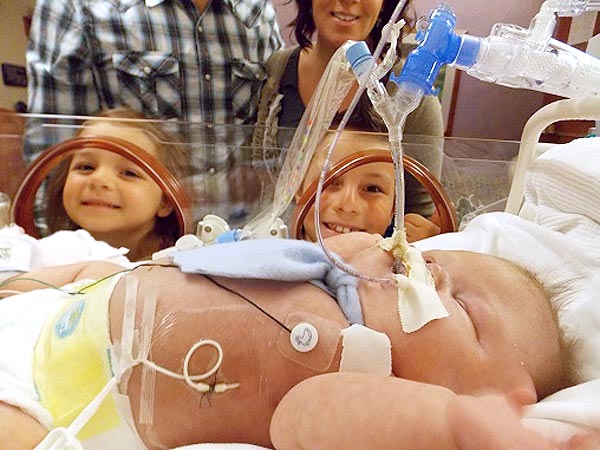 South Dakota Baby Given a Slim Chance of Living Celebrates Second Birthday| Kids & Family Life, Battling Illnesses, Real People Stories