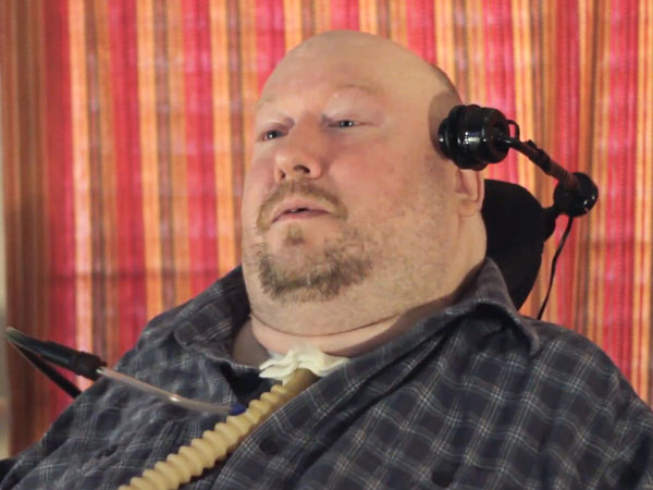 Man Born with Upside-Down Head Defies the Odds, Shares His Inspirational Story (VIDEO)| Around the Web, Real People Stories