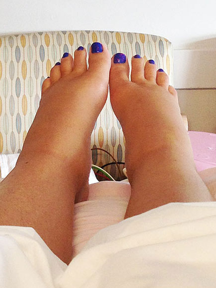 Diem Brown Shares Intimate Photos of Her Toughest Cancer Fight Yet| MTV, Cancer, Health, Battling Illnesses, Diem Brown