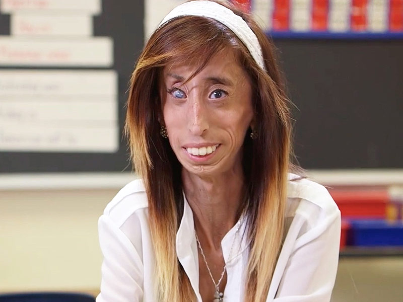 How Being Called 'World's Ugliest Woman' Turned a 17-Year-Old into an Activist