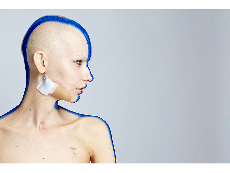 Model Poses for Gorgeous Photo Shoot After Losing Part of Her Jaw to Cancer (Photos)| Cancer, Bodywatch, Models