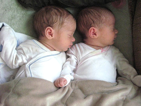 5-Year Old Donates Stem Cells to Save the Life of Her Twin Brother: 'The Love They Have Is Now Even Stronger,' Says Mom| Medical Conditions, Real People Stories, Real Heroes