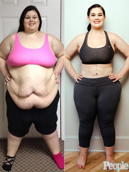 Kaitlyn Smith Is Engaged After Losing 208 Lbs. and Having 3 Skin-Removal Surgeries: 'I Never Thought I Would Be Happy'| Diet & Fitness, Bodywatch, Kaitlyn Smith