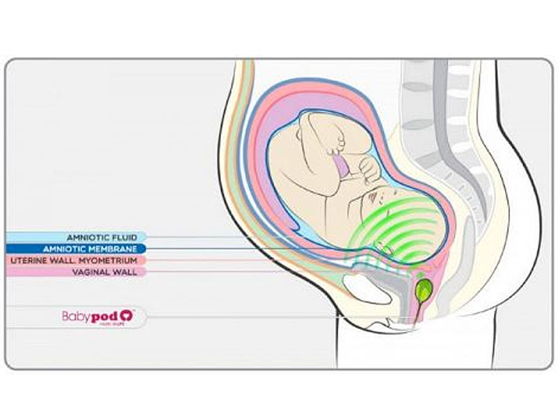 Babypod! Expecting Mothers Can Play Music for Fetuses Using New Tampon-Like Device| Babies, Pregnancy, Pregnancy, Bodywatch, Real People Stories