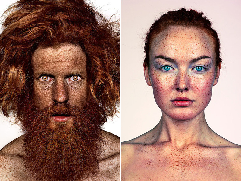 This Photo Series Proves Just How Beautiful Freckles Really Are| Bodywatch