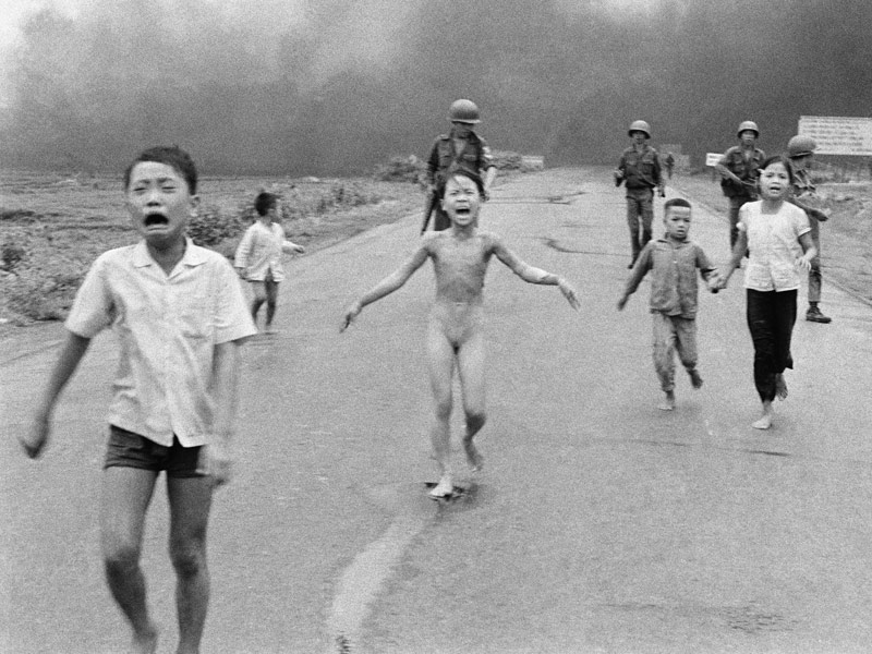 How the Vietnam War's 'Napalm Girl' Is Finally Getting Her Scars Treated – 43 Years Later | Vietnam, Real People Stories