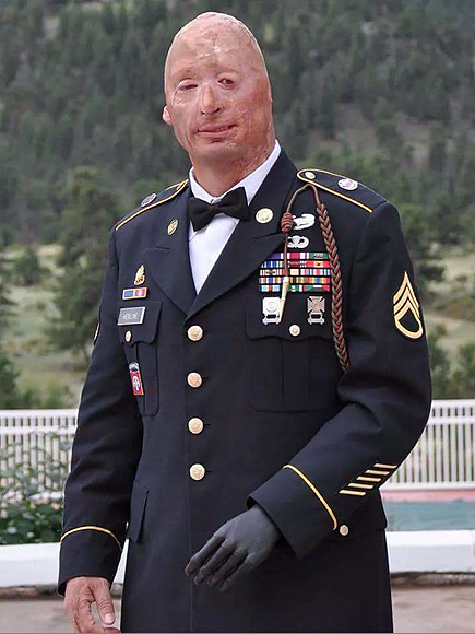 Inspiring Wounded Veteran Hopes to Open Restaurant to 'Empower' and Employ Other Veterans: 'God Kept Me Alive for a Reason'| Good Deeds, Real People Stories, Military and Soldiers, Real Heroes