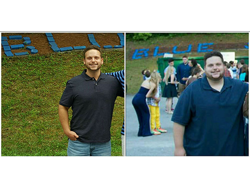 Man Who Became Obese After Death of His Father Drops 187 Lbs., Now Raising Money for Skin Removal Surgery| Diet & Fitness, Body shaming, Amazing Weight Loss, Bodywatch