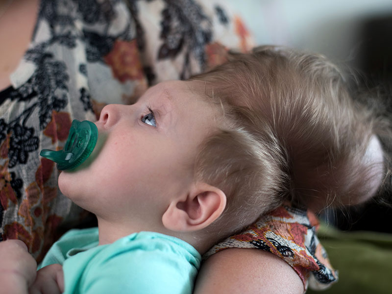 los Padres de familia Que se Negó a Abortar a un Bebé con Cerebro Fuera del Cráneo se Abren Sobre el Hijo de's Transformadora de la Cirugía: 'Usted Puede Sentir que Su Voluntad de Vivir'| Condiciones Médicas, Real Historias de la Gente