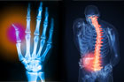 injuries to body parts as a result of working around the house