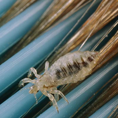 Nit-picking service - How to Get Rid of Head Lice - Health.com