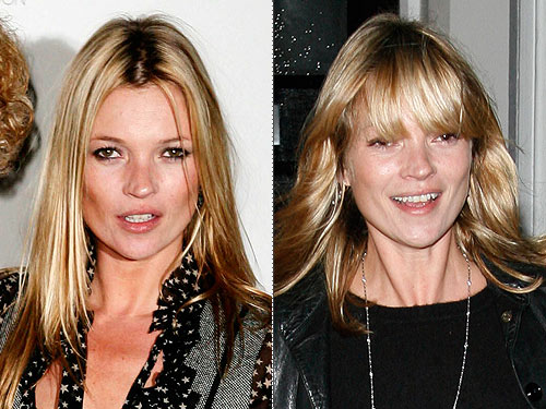 kate moss before and after