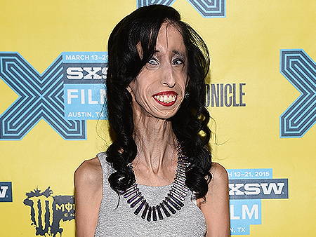 VIDEO: When Was the Last Time Lizzie Velasquez Was Inspired? : Video ...